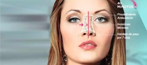 cirugia de nariz estética doctor afanador