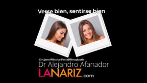 costo de rinoplastia